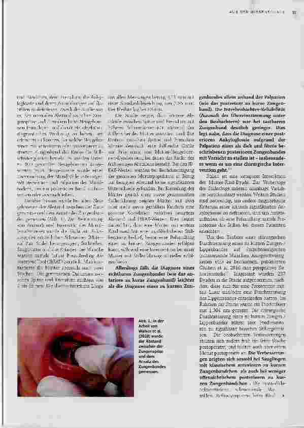 Vorschauseite 2: Ankyloglossie
