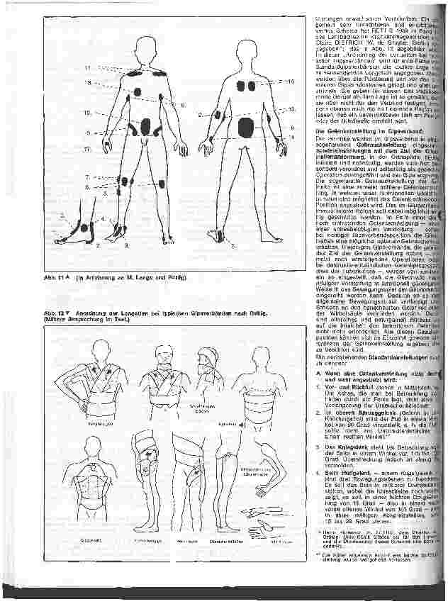 Vorschauseite 3: Die besonderen Aufgaben der Schwester in der Orthopädie 4. Folge: Allgemeines zur Gipsbehandlung in der Orthpädie