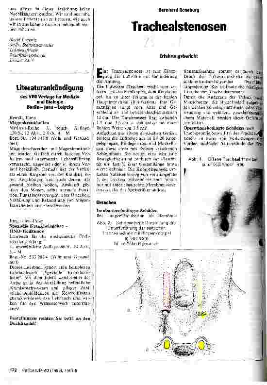 Vorschauseite 1: Trachealstenosen Erfahrungsbericht