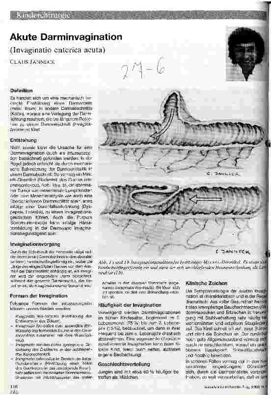 Vorschauseite 1: Akute Darminvagination Invagination enterica acuta