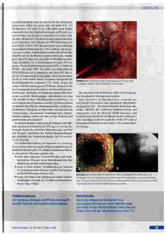 Vorschauseite 5: Effiziente Diagnostik und Therapie oberer gastrointestinaler Blutungen