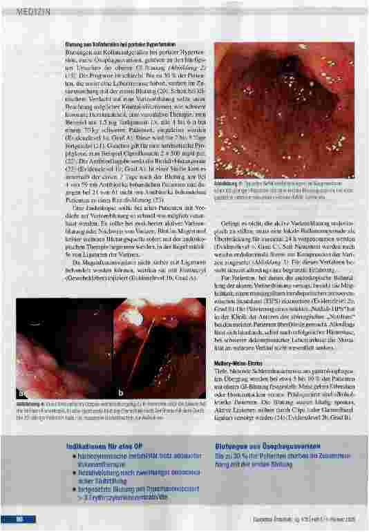 Vorschauseite 6: Effiziente Diagnostik und Therapie oberer gastrointestinaler Blutungen