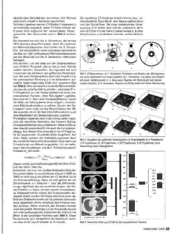 Vorschauseite 3: Computertomographie -Technik und Strahlenexposition