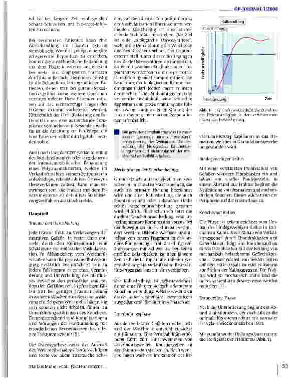 Vorschauseite 2: Fixateur externe und Knochenbruchheilung