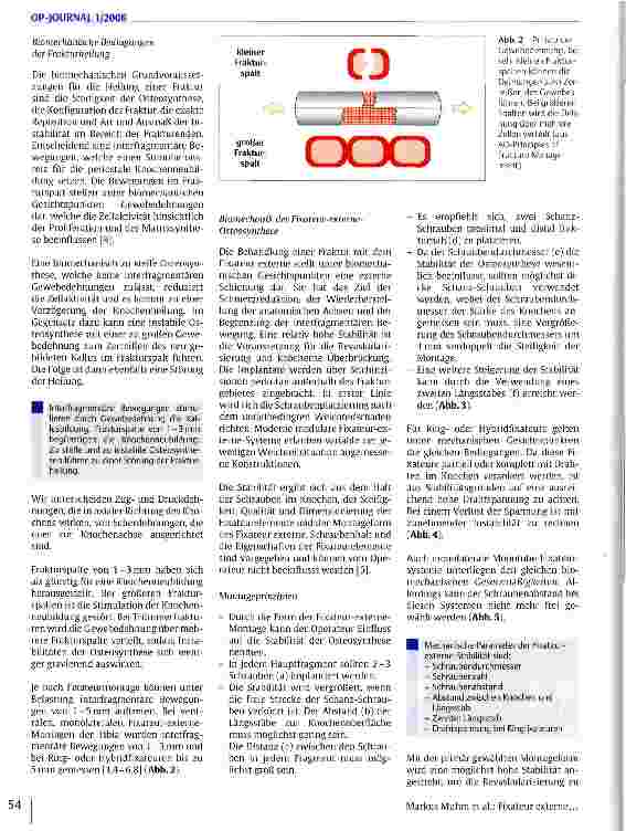 Vorschauseite 3: Fixateur externe und Knochenbruchheilung