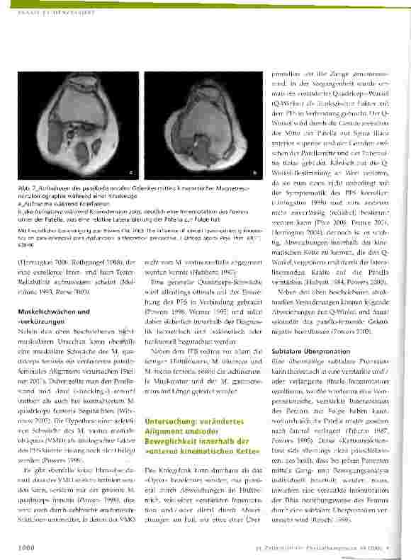 Vorschauseite 3: Patello-femorales Schmerzsyndrom Clinical Reasoning und evidenzbasierte Behandlung