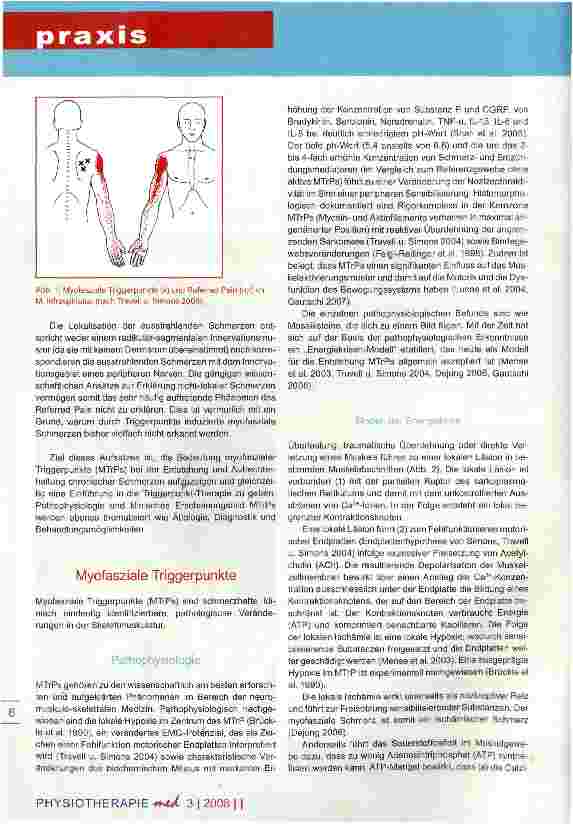 Vorschauseite 2: Triggerpunkt-Therapie bei chronischen Schmerzen