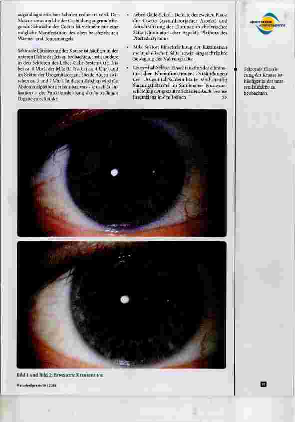Vorschauseite 2: Die vier wichtigsten Zeichen der Irisdiagnostik Teil 2