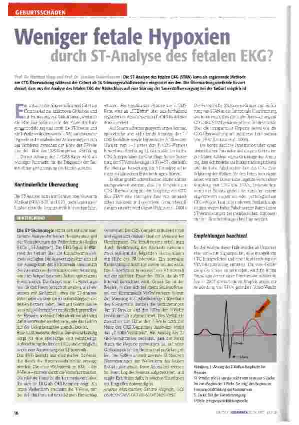 Vorschauseite 1: Weniger fetale Hypoxien durch ST-Analyse des fetalen EKG?