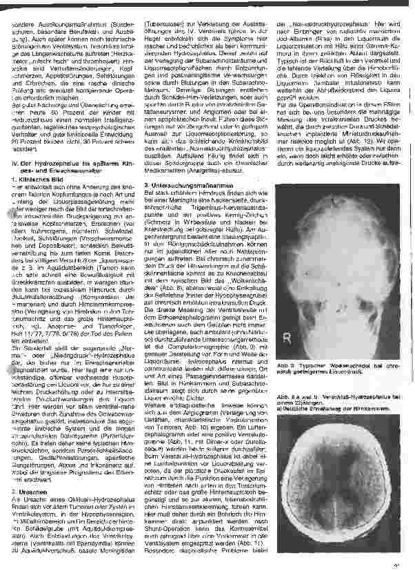 Vorschauseite 5: Themen aus der Neurochirurgie 16. Folge: Der Hydrozephalus