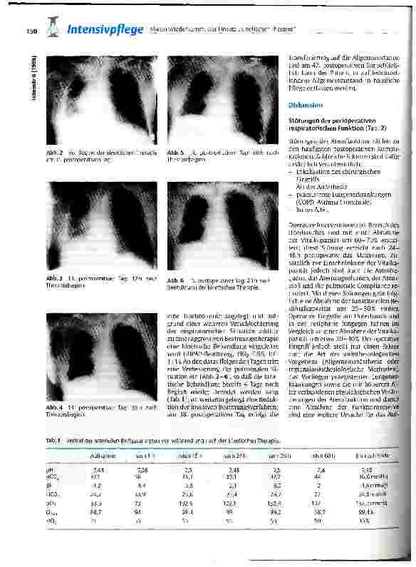 Vorschauseite 2: Der Einsatz kinetischer Therapie bei postoperativen respiratorischen Störungen. Eine Kasuistik!