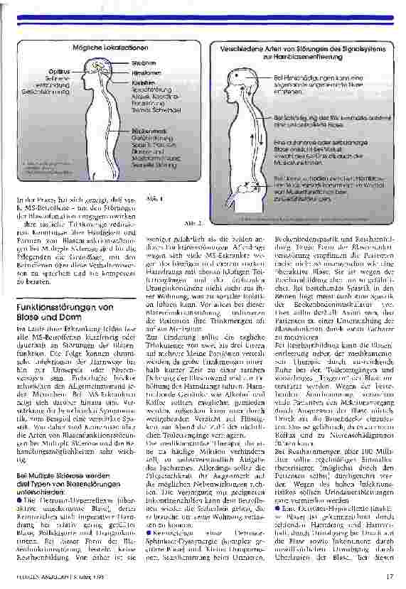 Vorschauseite 3: Multiple Sklerose Keiner weiß woher sie kommt und wohin sie führt
