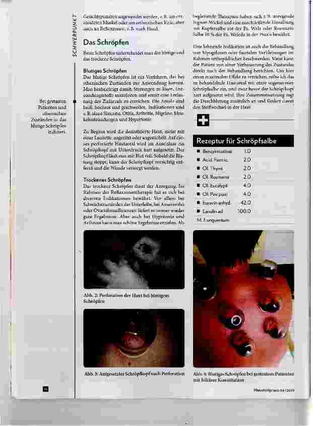 Vorschauseite 3: Abund Ausleitungsverfahren der Humoralpathologie
