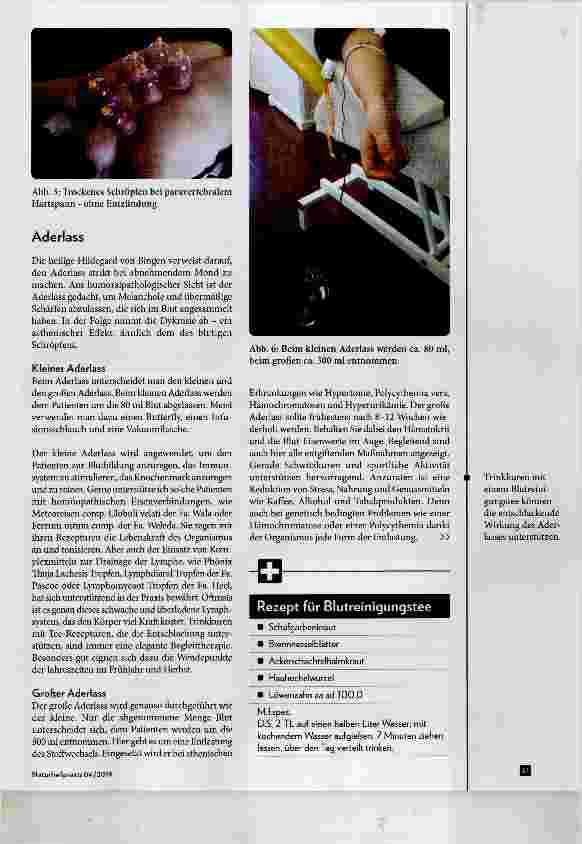 Vorschauseite 4: Abund Ausleitungsverfahren der Humoralpathologie