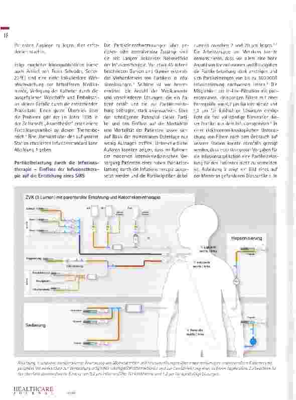 Vorschauseite 6: Strategien zur Vermeidung von Infusionstherapie-assoziierten Komplikationen