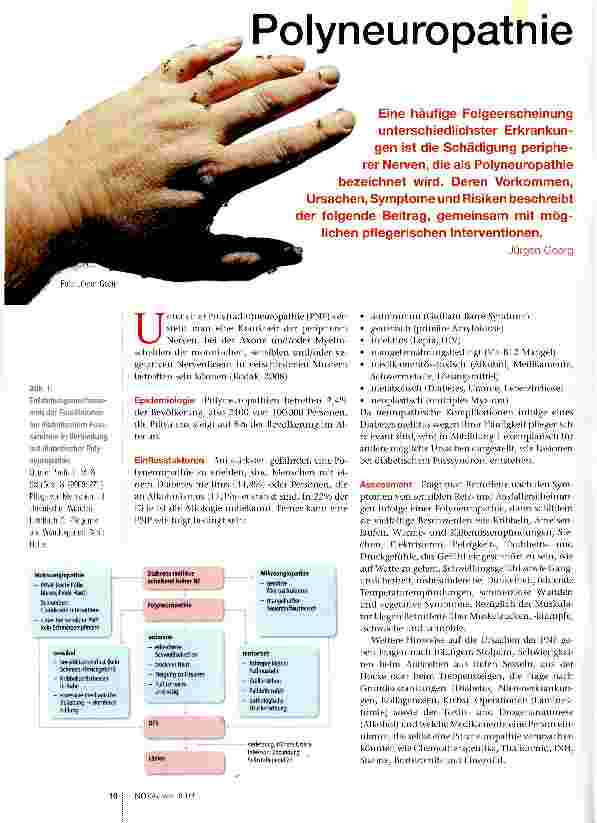 Vorschauseite 1: Polyneuropatnie