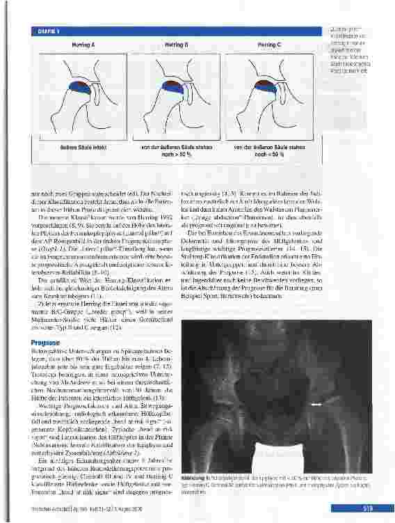 Vorschauseite 3: Morbus Perthes