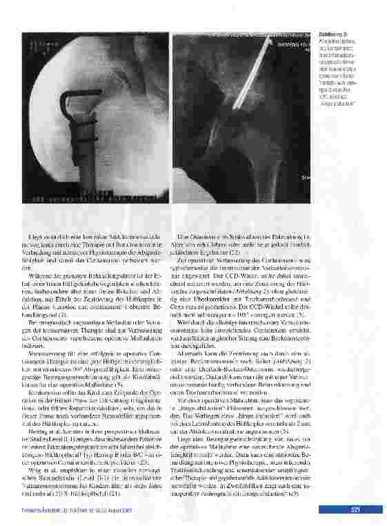 Vorschauseite 5: Morbus Perthes