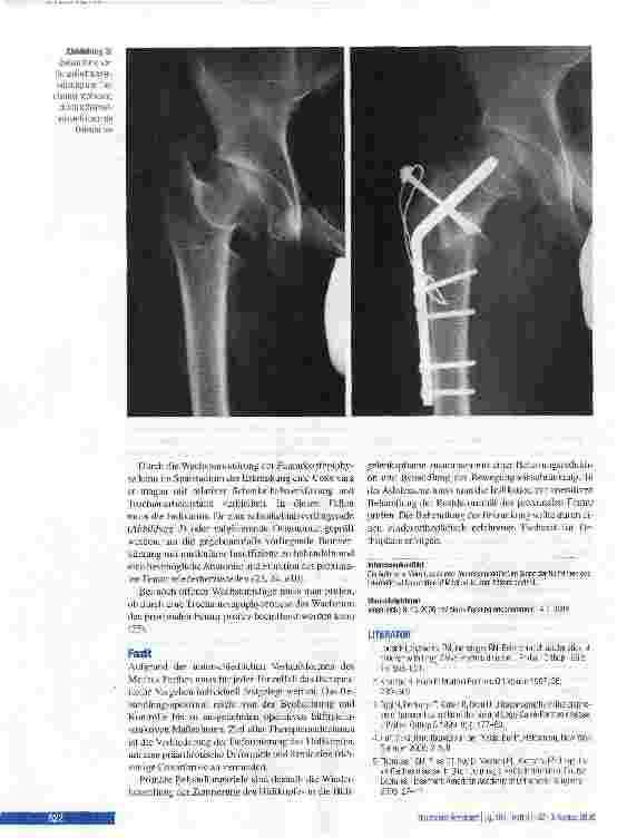 Vorschauseite 6: Morbus Perthes