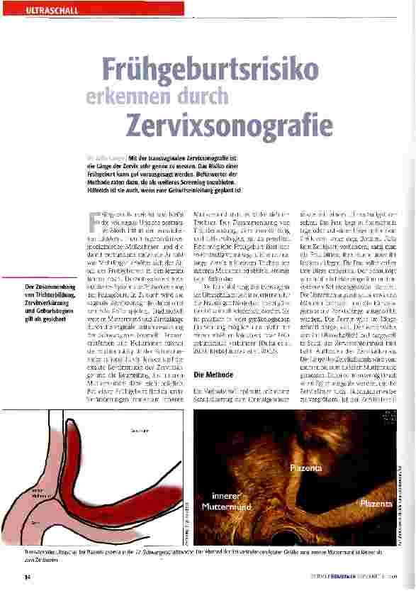 Vorschauseite 1: Frühgeburtsrisiko erkennen durch Zervixsonografie
