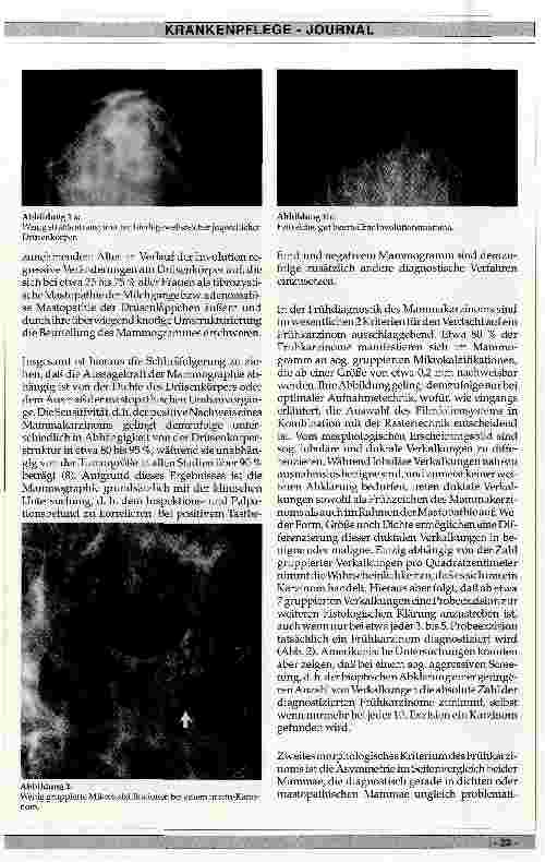 Vorschauseite 2: Diagnostik des Mammakarzinoms