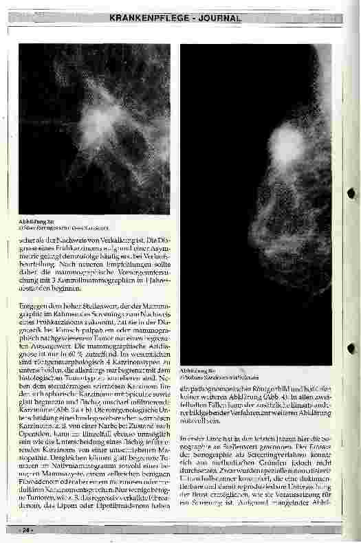 Vorschauseite 3: Diagnostik des Mammakarzinoms