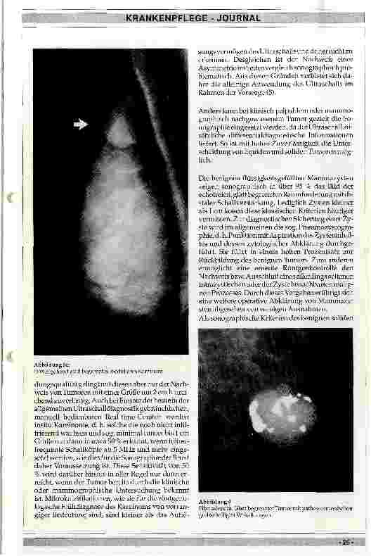 Vorschauseite 4: Diagnostik des Mammakarzinoms