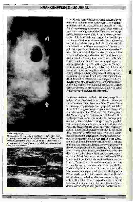 Vorschauseite 5: Diagnostik des Mammakarzinoms