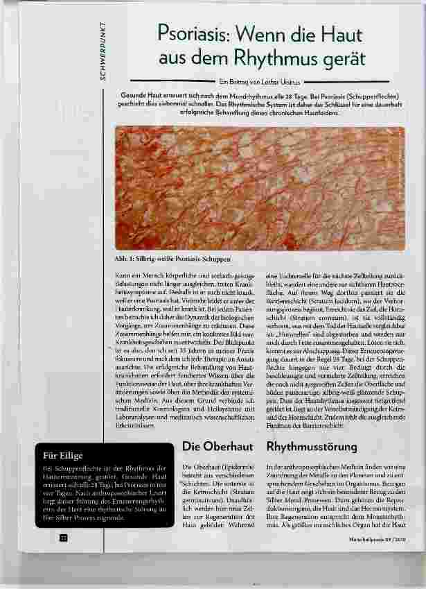 Vorschauseite 1: Psoriasis: Wenn die Haut aus dem Rhythmus gerät
