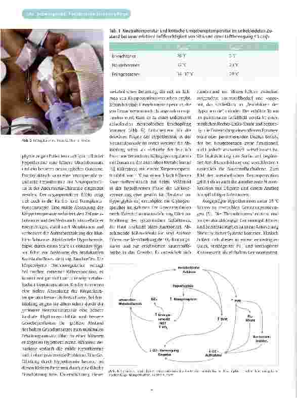 Vorschauseite 5: Perioperative Temperaturregulation bei Kindern