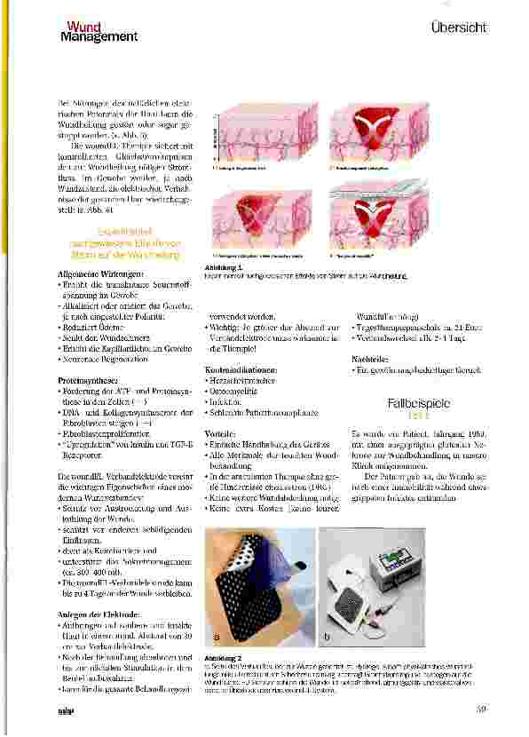Vorschauseite 2: Elektrostimulation in der Wundversorgung — eine Anwendungsbeobachtung