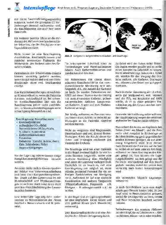 Vorschauseite 3: Pflege und Lagerung beatmeter Patientinnen und Patienten mit ARDS