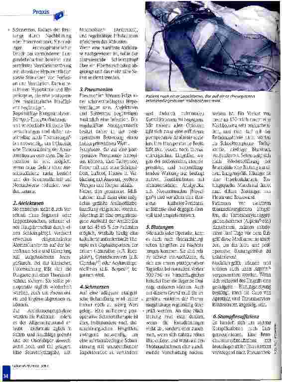 Vorschauseite 3: Aufgaben der Pflege in der Thoraxchirurgie Perioperative Therapieprobleme, Teil 4