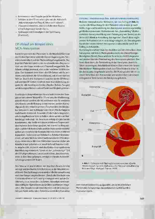 Vorschauseite 2: Aneurysma-Clipping