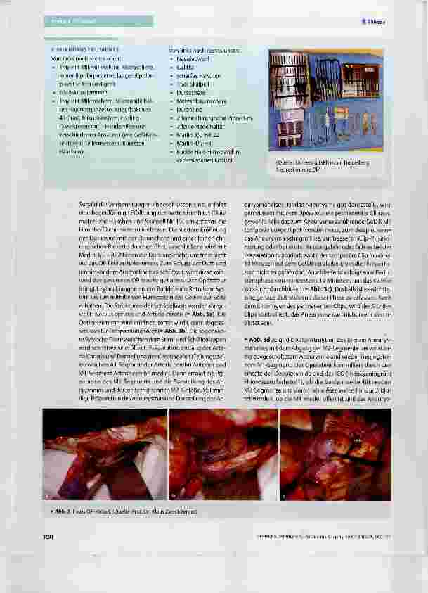 Vorschauseite 5: Aneurysma-Clipping