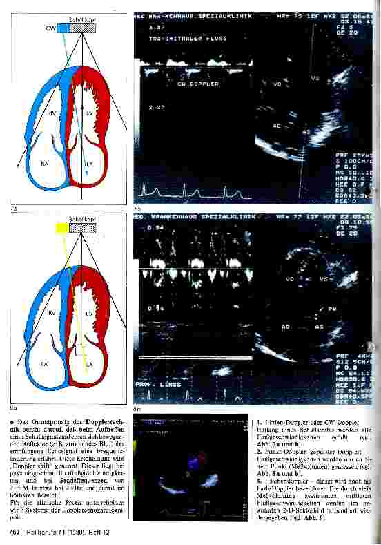 Vorschauseite 3: Ultraschalldiagnostik des Herzens bei Hypertonie Weiterbildungsbeitrag für Fachkrankenschwestern