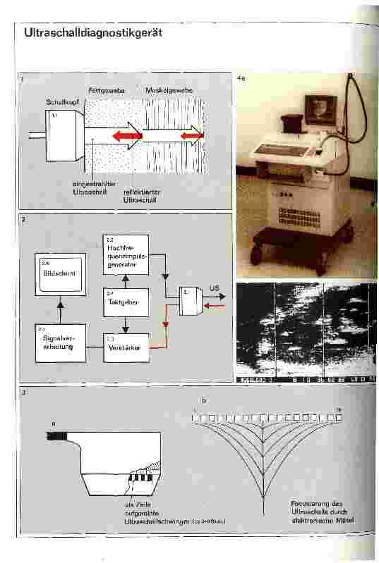 Vorschauseite 1: Medizintechnische Geräte Ultraschalldiagnostik