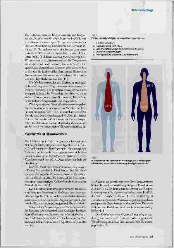 Vorschauseite 4: Perioperative Hypothermie vermeiden