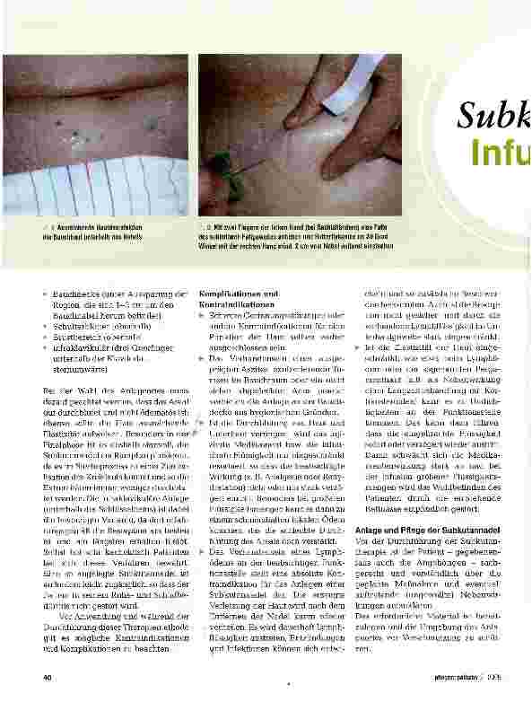 Vorschauseite 2: Subkutane Infusion