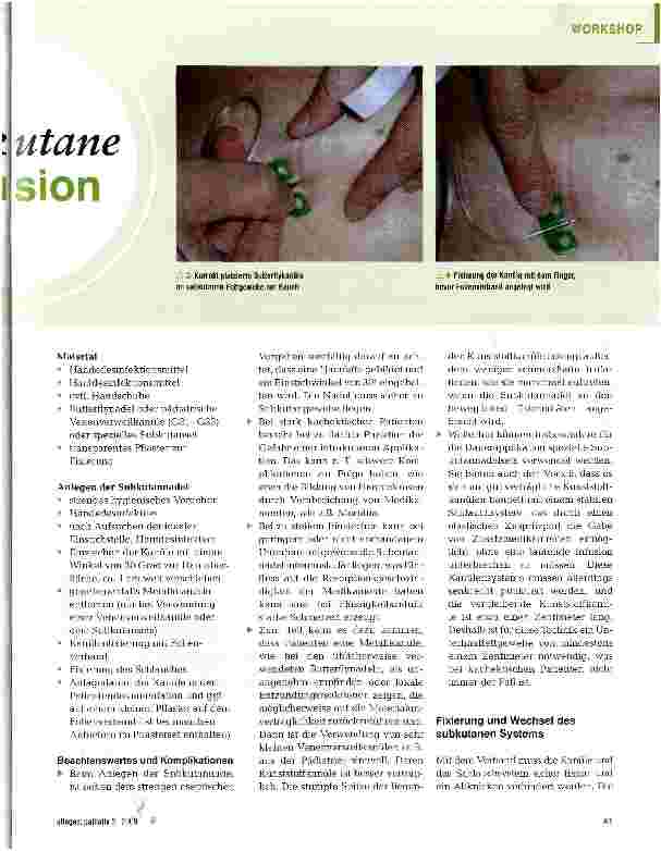 Vorschauseite 3: Subkutane Infusion