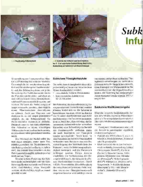 Vorschauseite 4: Subkutane Infusion