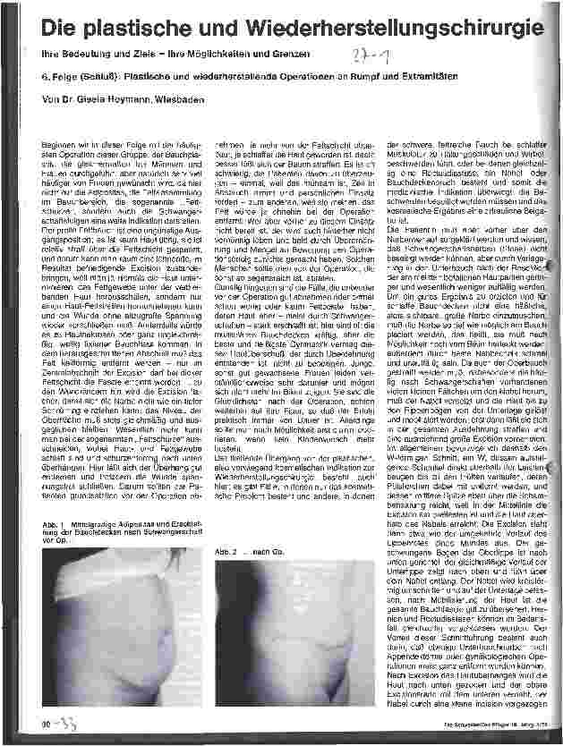 Vorschauseite 1: Die plastische und Wiederherstellungschirurgie 6. Folge: Plastische u. wiederherstellende OP an Rumpf u. Extrimitäten