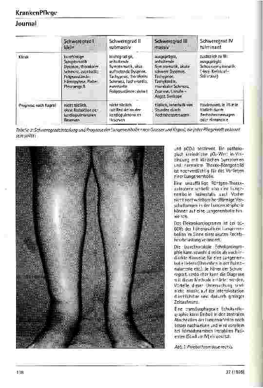 Vorschauseite 3: Akute Lungenembolie bei chirurgischen Patienten - Eine schwerwiegende perioperative Komplikation