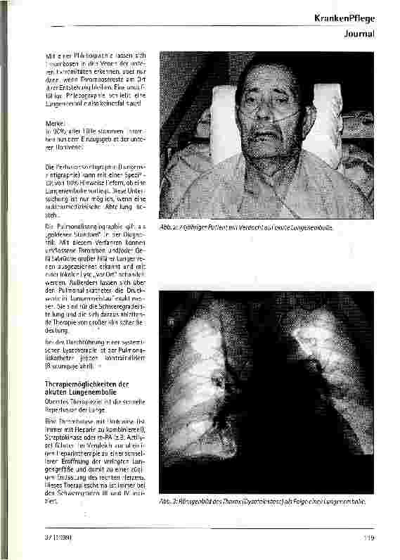 Vorschauseite 4: Akute Lungenembolie bei chirurgischen Patienten - Eine schwerwiegende perioperative Komplikation