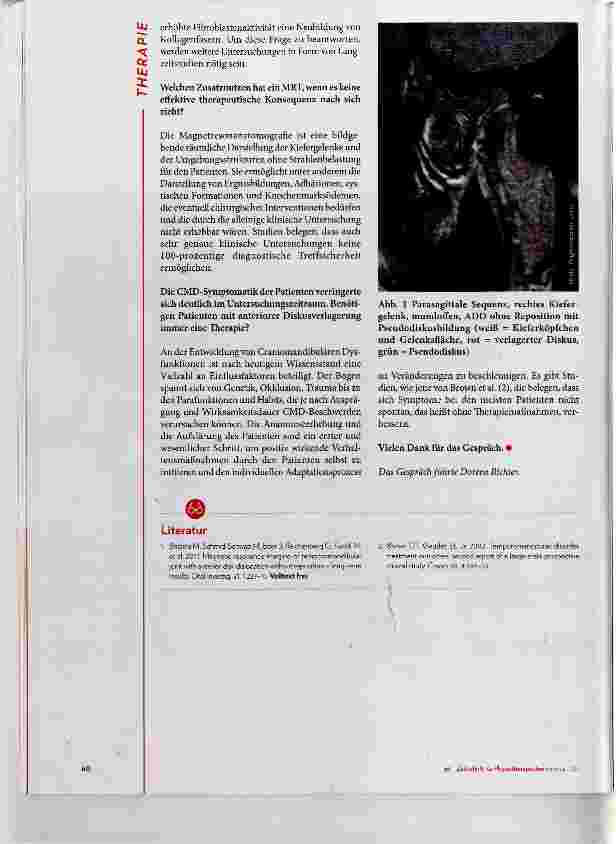 Vorschauseite 3: Pseudodiskus bei CMD-Patienten ?