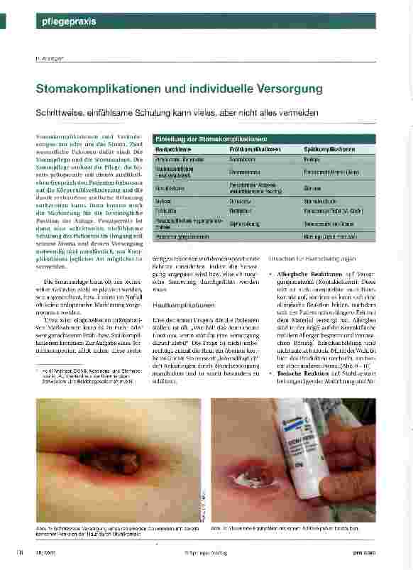 Vorschauseite 1: Stomakomplikationen und individuelle Versorgung