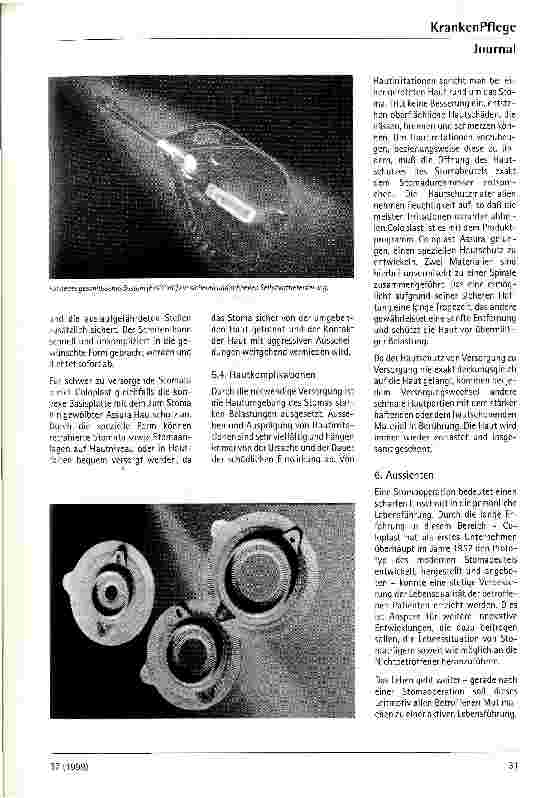 Vorschauseite 5: ...und das Leben geht weiter! Das Stoma und dessen Versorgung