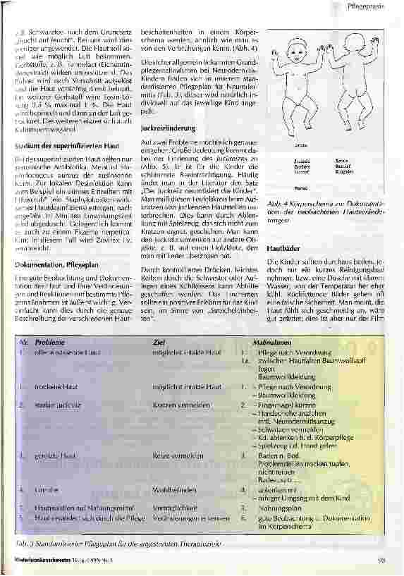 Vorschauseite 3: Neurodermitis - Endogenes Ekzem - Atopische Dermatitis - Atopisches Ekzem