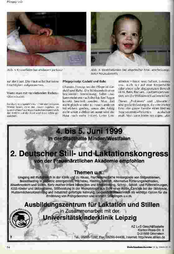 Vorschauseite 4: Neurodermitis - Endogenes Ekzem - Atopische Dermatitis - Atopisches Ekzem