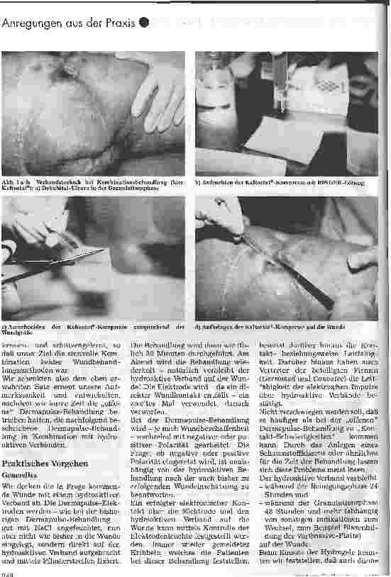 Vorschauseite 2: Kombination der Dermapulse-Behandlung mit hydroaktiven Verbänden Ein Erfahrungsbericht über eine modifizierte Wundbehandlungsmethode bei Dekubital-Ulcera